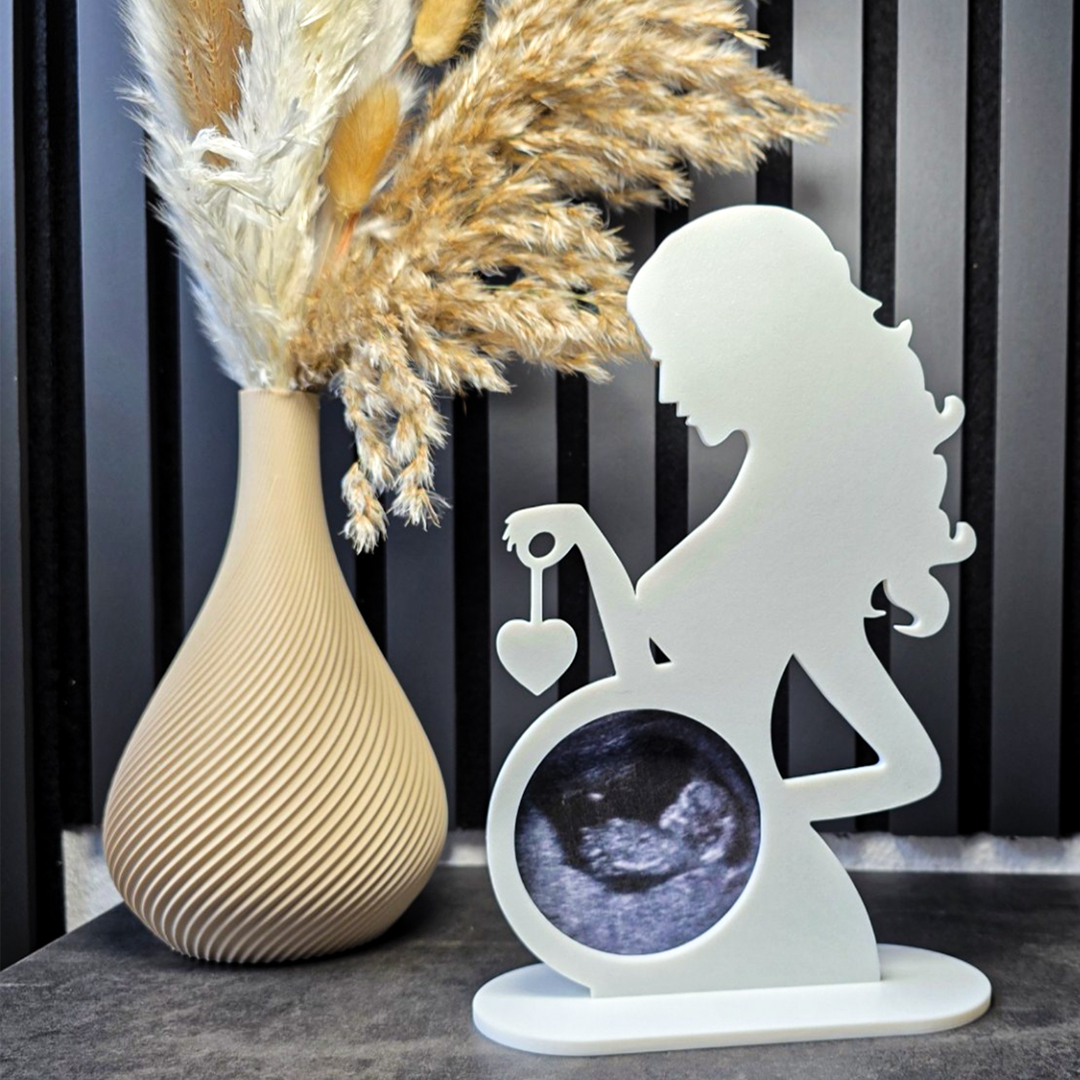 Custom Ultrasound Photo Frame for Mothers – Baby Scan Keepsake Decoration